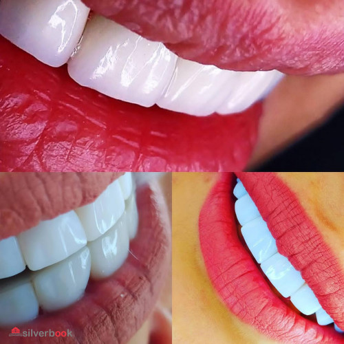کلینیک دندانپزشکی جیحون | ایمپلنت زیبایی غرب | دکتر بدرالسادات مرتضوی