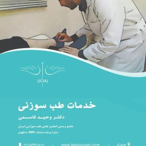 طب سوزنی شمال تهران