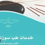 طب سوزنی شمال تهران | درمان درد با طب سوزنی | درمان میگرن با طب سوزنی