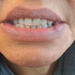 دندانسازی شرق | دندانسازی تهرانپارس | لابراتوار پروتزهای دندانی متحرک
